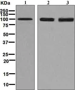 Western blot - Anti-Desmocollin 3 antibody [EPR7486] - BSA and Azide free (AB248176)