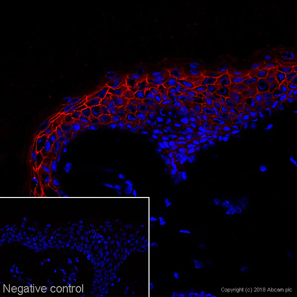 Immunohistochemistry (Frozen sections) - Anti-Desmoglein 1/DSG1 antibody [27B2] (AB12077)