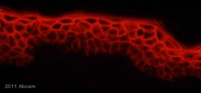 Immunohistochemistry (Frozen sections) - Anti-Desmoglein 1/DSG1 antibody [27B2] (AB12077), expandable thumbnail