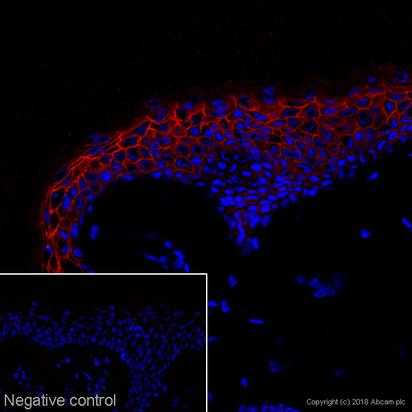 Immunohistochemistry (Frozen sections) - Anti-Desmoglein 1/DSG1 antibody [27B2] - BSA and Azide free (AB269569), expandable thumbnail
