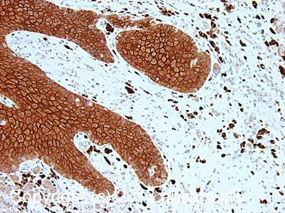 Immunohistochemistry (Formalin/PFA-fixed paraffin-embedded sections) - Anti-Desmoglein 1/DSG1 antibody [32-2B] (AB108490), expandable thumbnail
