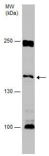 Western blot - Anti-Desmoglein 1/DSG1 antibody - C-terminal (AB227925), expandable thumbnail