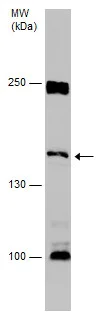 Western blot - Anti-Desmoglein 1/DSG1 antibody - C-terminal (AB227925)