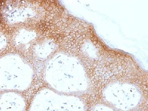 Immunohistochemistry (Formalin/PFA-fixed paraffin-embedded sections) - Anti-Desmoglein 1/DSG1 antibody [DSG1/1733] (AB218378)