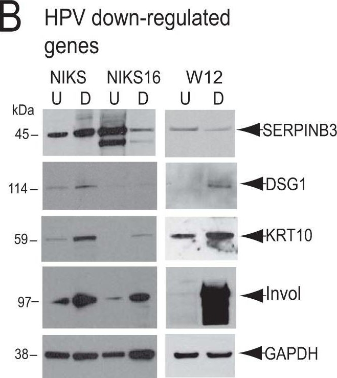 Western blot - Anti-Desmoglein 1/DSG1 antibody [EP6765] (AB133662), expandable thumbnail