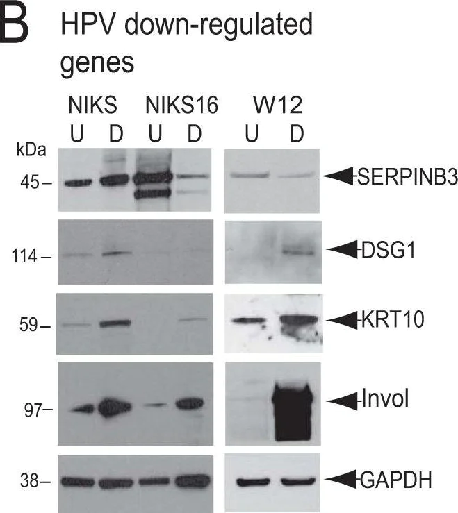 Western blot - Anti-Desmoglein 1/DSG1 antibody [EP6765] (AB133662)