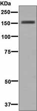 Western blot - Anti-Desmoglein 1/DSG1 antibody [EP6765] - BSA and Azide free (AB284807), expandable thumbnail