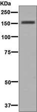 Western blot - Anti-Desmoglein 1/DSG1 antibody [EP6765] - BSA and Azide free (AB284807)