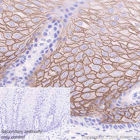 Immunohistochemistry (Formalin/PFA-fixed paraffin-embedded sections) - Anti-Desmoglein 1/DSG1 antibody [EPR20382] (AB209490)