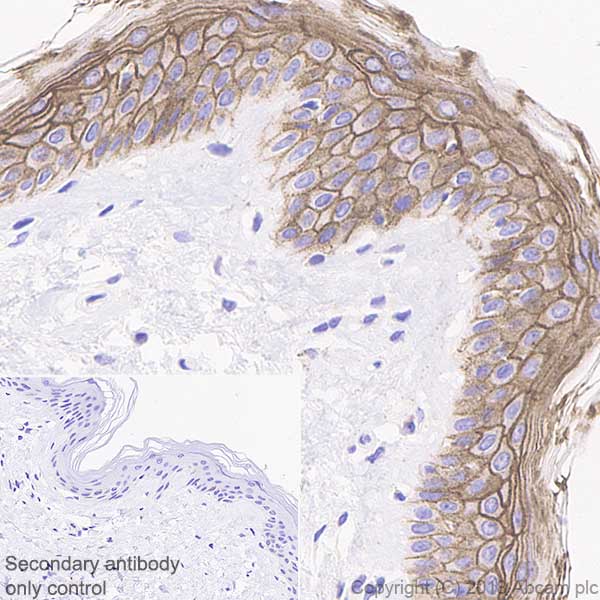 Immunohistochemistry (Formalin/PFA-fixed paraffin-embedded sections) - Anti-Desmoglein 1/DSG1 antibody [EPR20382] (AB209490), expandable thumbnail