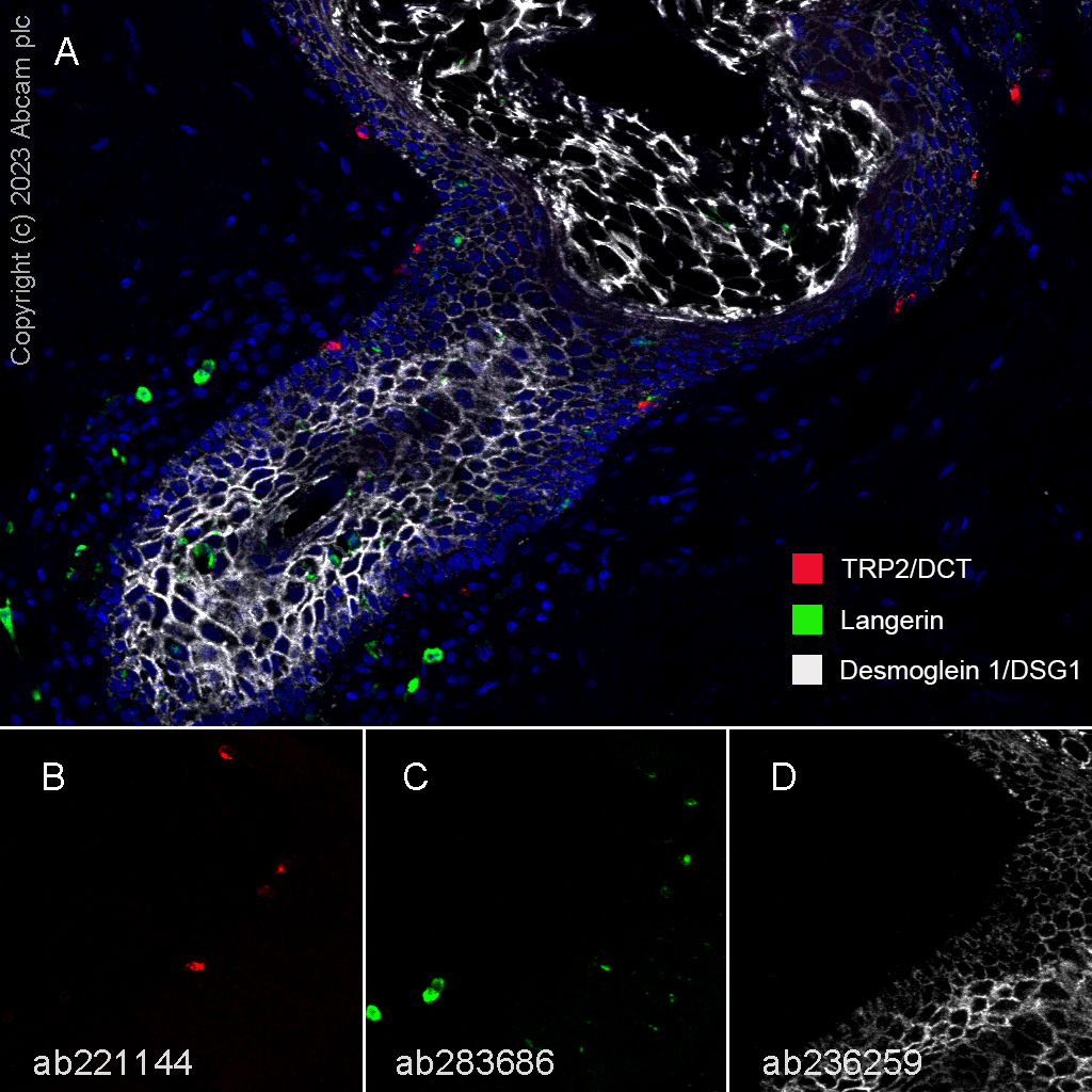 Multiplex immunohistochemistry - Anti-Desmoglein 1/DSG1 antibody [EPR20382] (AB209490), expandable thumbnail