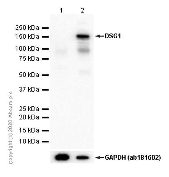 Western blot - Anti-Desmoglein 1/DSG1 antibody [EPR20382] (AB209490), expandable thumbnail
