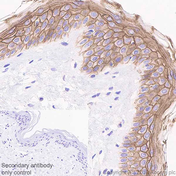 Immunohistochemistry (Formalin/PFA-fixed paraffin-embedded sections) - Anti-Desmoglein 1/DSG1 antibody [EPR20382] - BSA and Azide free (AB236259)