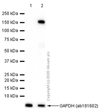 Western blot - Anti-Desmoglein 1/DSG1 antibody [EPR6766(B)] (AB124798)