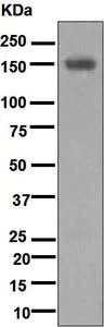 Western blot - Anti-Desmoglein 1/DSG1 antibody [EPR6766(B)] (AB124798)