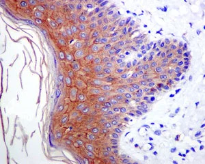 Immunohistochemistry (Formalin/PFA-fixed paraffin-embedded sections) - Anti-Desmoglein 1/DSG1 antibody [EPR6766(B)] - BSA and Azide free (AB228343)