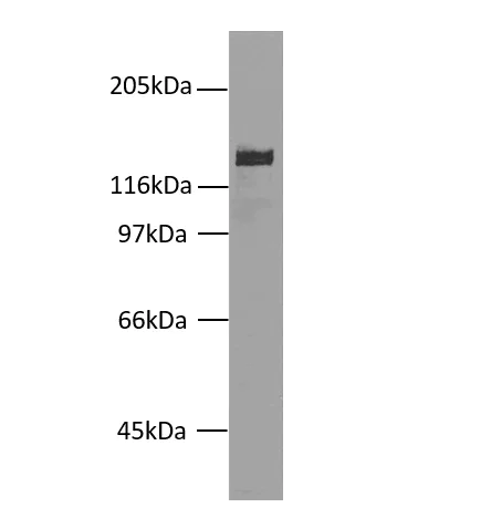 Western blot - Anti-Desmoglein 2/DSG2 Antibody [7H9] (AB316363)