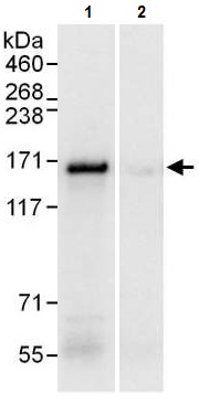 Immunoprecipitation - Anti-Desmoglein 2/DSG2 antibody (AB226184)