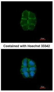 Immunocytochemistry/ Immunofluorescence - Anti-Desmoglein 2/DSG2 antibody (AB96761)