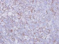 Immunohistochemistry (Formalin/PFA-fixed paraffin-embedded sections) - Anti-Desmoglein 2/DSG2 antibody (AB96761), expandable thumbnail