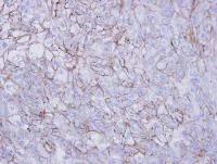 Immunohistochemistry (Formalin/PFA-fixed paraffin-embedded sections) - Anti-Desmoglein 2/DSG2 antibody (AB96761)