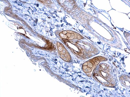 Immunohistochemistry (Formalin/PFA-fixed paraffin-embedded sections) - Anti-Desmoglein 2/DSG2 antibody (AB96761), expandable thumbnail