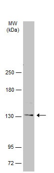 Western blot - Anti-Desmoglein 2/DSG2 antibody (AB96761), expandable thumbnail