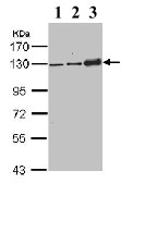Western blot - Anti-Desmoglein 2/DSG2 antibody (AB96761), expandable thumbnail