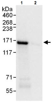 Immunoprecipitation - Anti-Desmoglein 2/DSG2 antibody - C-terminal (AB226258), expandable thumbnail