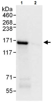 Immunoprecipitation - Anti-Desmoglein 2/DSG2 antibody - C-terminal (AB226258)