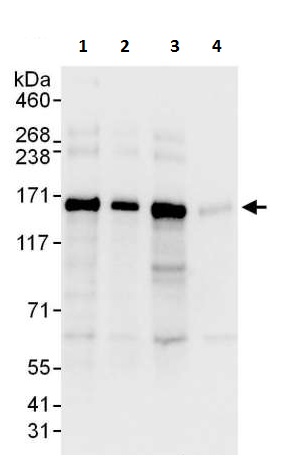 Western blot - Anti-Desmoglein 2/DSG2 antibody - C-terminal (AB226258), expandable thumbnail