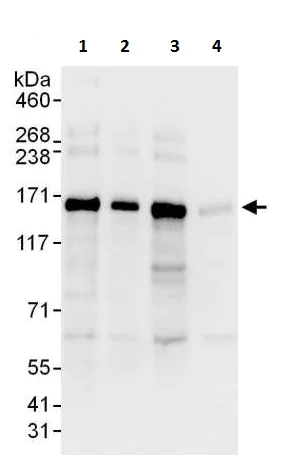 Western blot - Anti-Desmoglein 2/DSG2 antibody - C-terminal (AB226258)