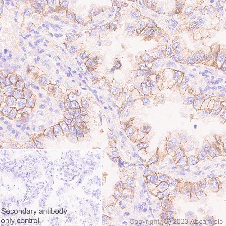 Immunohistochemistry (Formalin/PFA-fixed paraffin-embedded sections) - Anti-Desmoglein 2/DSG2 antibody [EPR26639-18] (AB315448)
