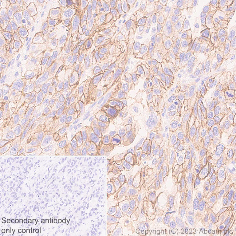 Immunohistochemistry (Formalin/PFA-fixed paraffin-embedded sections) - Anti-Desmoglein 2/DSG2 antibody [EPR26639-18] (AB315448)