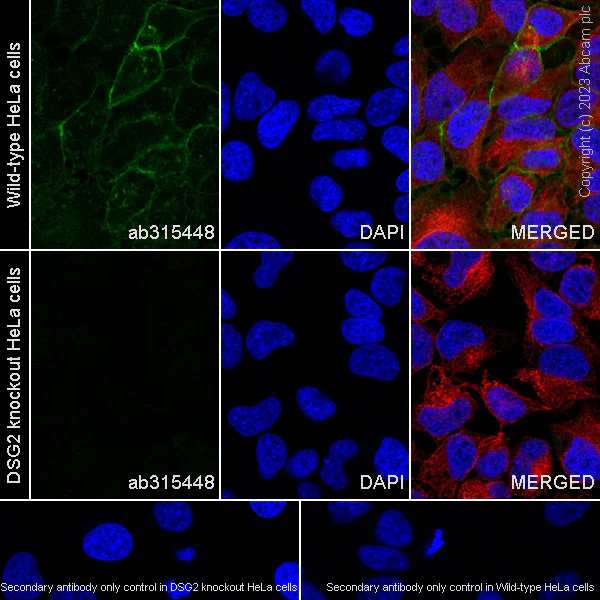 Immunocytochemistry/ Immunofluorescence - Anti-Desmoglein 2/DSG2 antibody [EPR26639-18] - BSA and Azide free (AB315449)