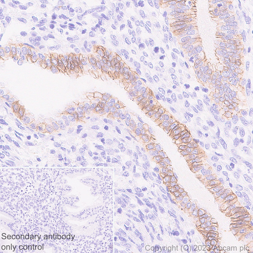 Immunohistochemistry (Formalin/PFA-fixed paraffin-embedded sections) - Anti-Desmoglein 2/DSG2 antibody [EPR26639-18] - BSA and Azide free (ab315449), expandable thumbnail