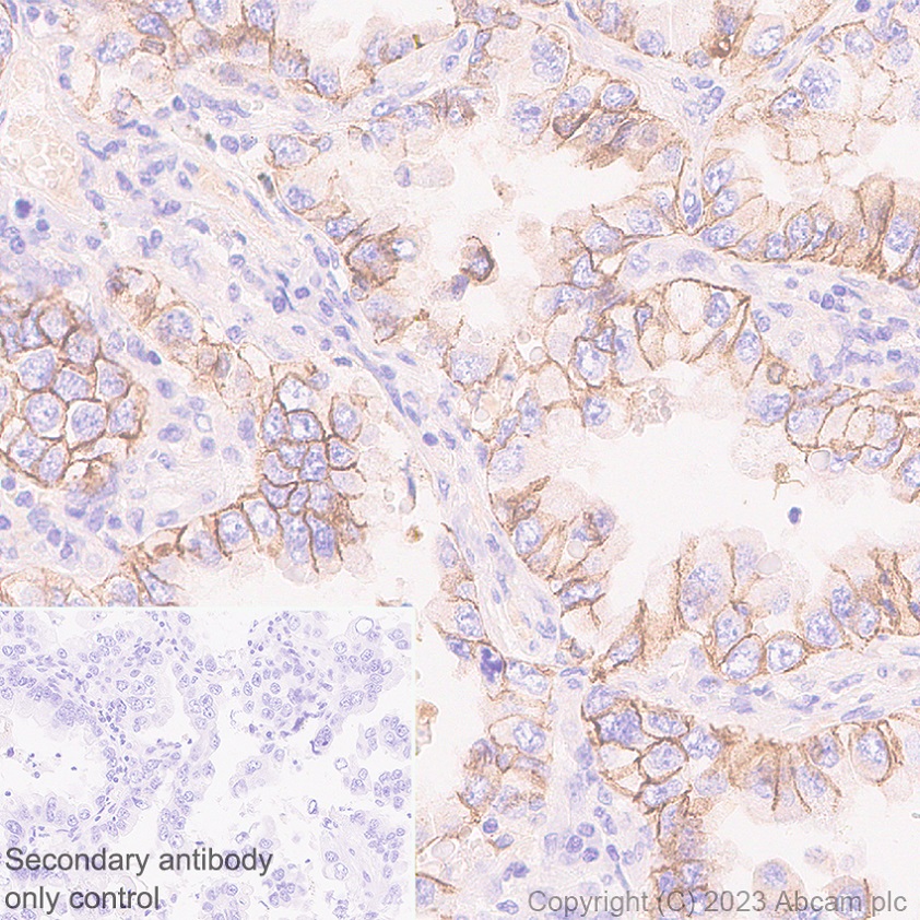 Immunohistochemistry (Formalin/PFA-fixed paraffin-embedded sections) - Anti-Desmoglein 2/DSG2 antibody [EPR26639-18] - BSA and Azide free (AB315449), expandable thumbnail