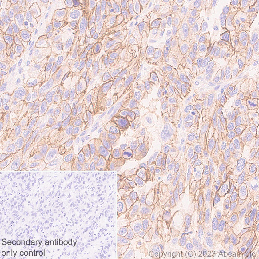 Immunohistochemistry (Formalin/PFA-fixed paraffin-embedded sections) - Anti-Desmoglein 2/DSG2 antibody [EPR26639-18] - BSA and Azide free (AB315449), expandable thumbnail