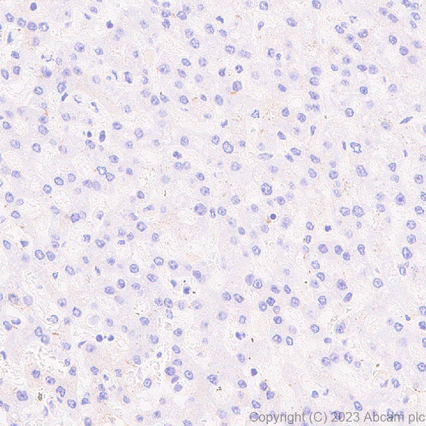Immunohistochemistry (Formalin/PFA-fixed paraffin-embedded sections) - Anti-Desmoglein 2/DSG2 antibody [EPR26639-18] - BSA and Azide free (AB315449), expandable thumbnail