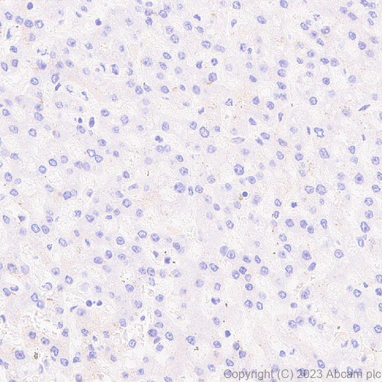 Immunohistochemistry (Formalin/PFA-fixed paraffin-embedded sections) - Anti-Desmoglein 2/DSG2 antibody [EPR26639-18] - BSA and Azide free (AB315449)