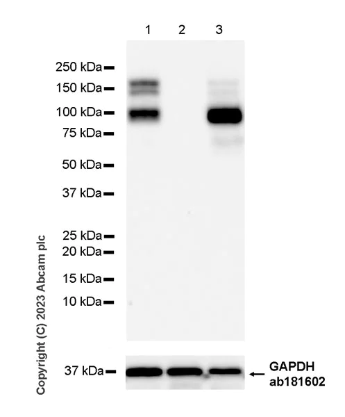 Western blot - Anti-Desmoglein 2/DSG2 antibody [EPR26639-18] - BSA and Azide free (AB315449)