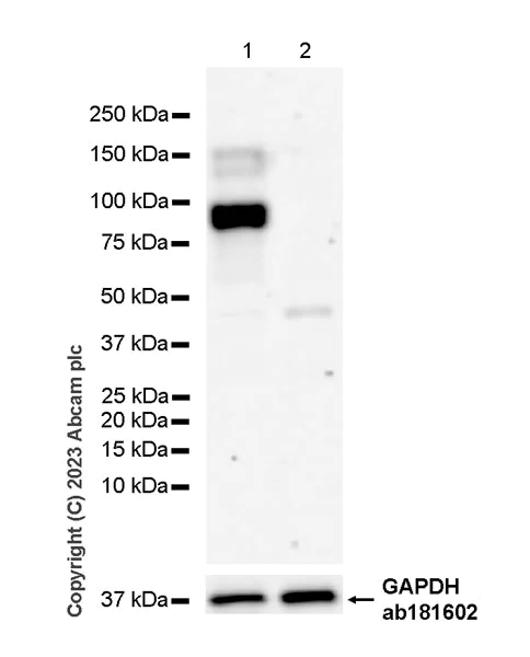 Western blot - Anti-Desmoglein 2/DSG2 antibody [EPR26639-18] - BSA and Azide free (AB315449)