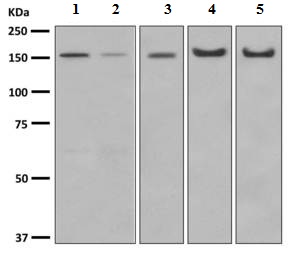Western blot - Anti-Desmoglein 2/DSG2 antibody [EPR6768] (AB150372), expandable thumbnail