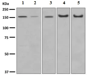 Western blot - Anti-Desmoglein 2/DSG2 antibody [EPR6768] (AB150372)
