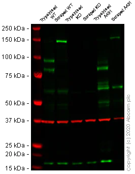 Western blot - Anti-Desmoglein 2/DSG2 antibody [EPR6768] - BSA and Azide free (AB271913)