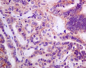Immunohistochemistry (Formalin/PFA-fixed paraffin-embedded sections) - Anti-Desmoglein 2/DSG2 antibody [EPR6768] - Low endotoxin, Azide free (AB230833), expandable thumbnail