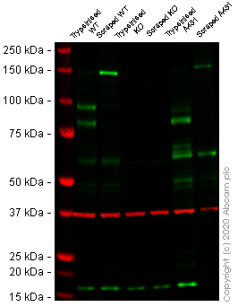 Western blot - Anti-Desmoglein 2/DSG2 antibody [EPR6768] - Low endotoxin, Azide free (AB230833), expandable thumbnail