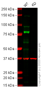 Western blot - Anti-Desmoglein 2/DSG2 antibody [EPR6768] - Low endotoxin, Azide free (AB230833), expandable thumbnail