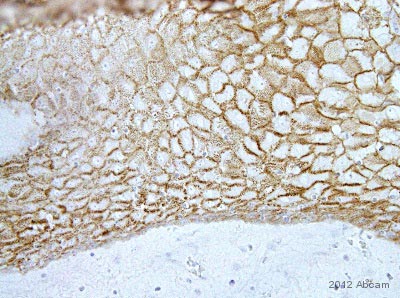 Immunohistochemistry (Formalin/PFA-fixed paraffin-embedded sections) - Anti-Desmoglein 3/PVA antibody [5G11] (AB14416), expandable thumbnail