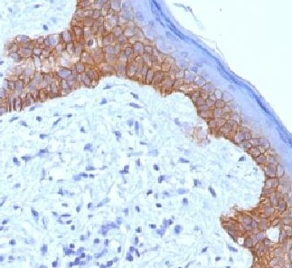 Immunohistochemistry (Formalin/PFA-fixed paraffin-embedded sections) - Anti-Desmoglein 3/PVA antibody [5G11] - BSA and Azide free (AB218851), expandable thumbnail
